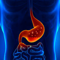 GE REFLUX-1