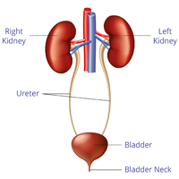 INDIRECT RADIONUCLIDE CYSTOGRAM